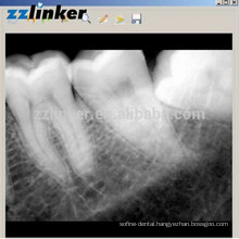 LK-C64 Yes Biotech Dental X-ray Sensor Dental Digital